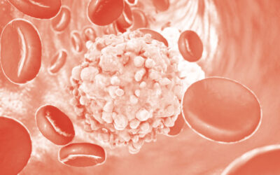 Leucemia linfatica cronica, Fda approva acalabrutinib