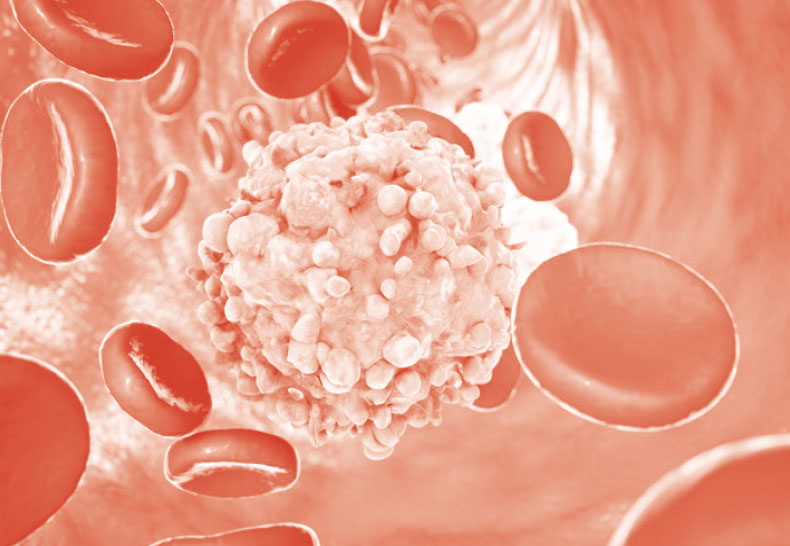Leucemia linfatica cronica, Fda approva acalabrutinib